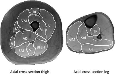 Human lower limb muscle cross sectional area scales with positive allometry reflecting bipedal evolutionary history